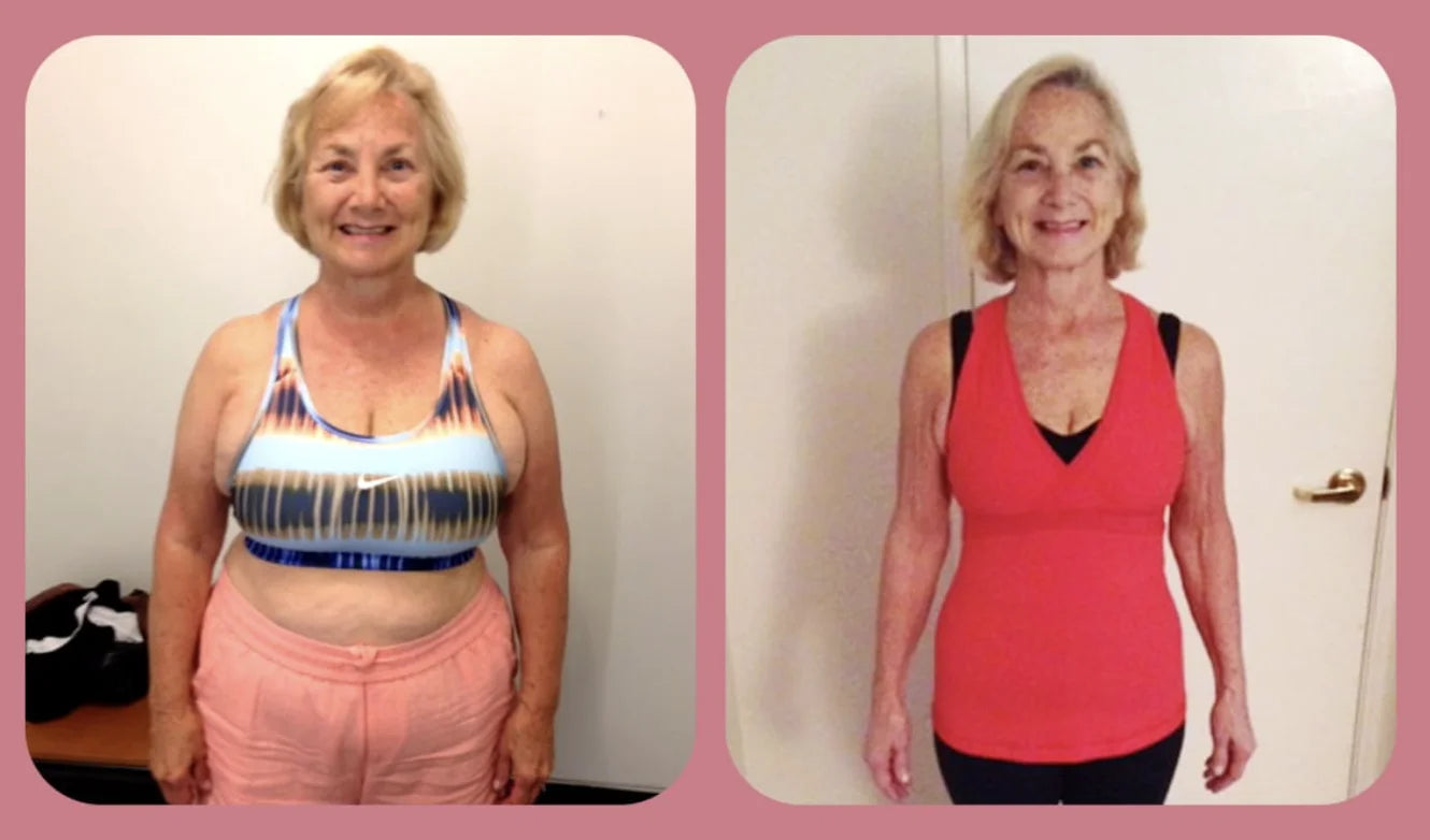 Melinda — before and after